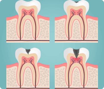 Endodontia