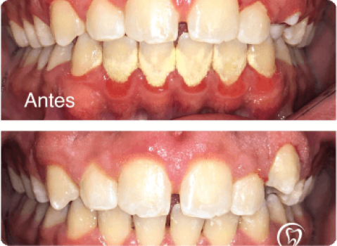 Periodontia